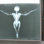 Radiografía del esmerejón con un ala fracturada Radiografía del esmerejón con un ala fracturada